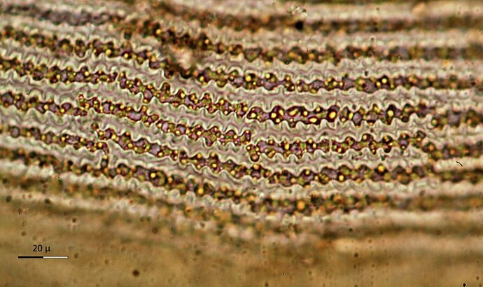 Racomitrium lanuginosum- cellules foliaires (Suède)